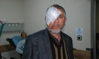 Yaralı kurtulanlar yaşadıklarını anlattı