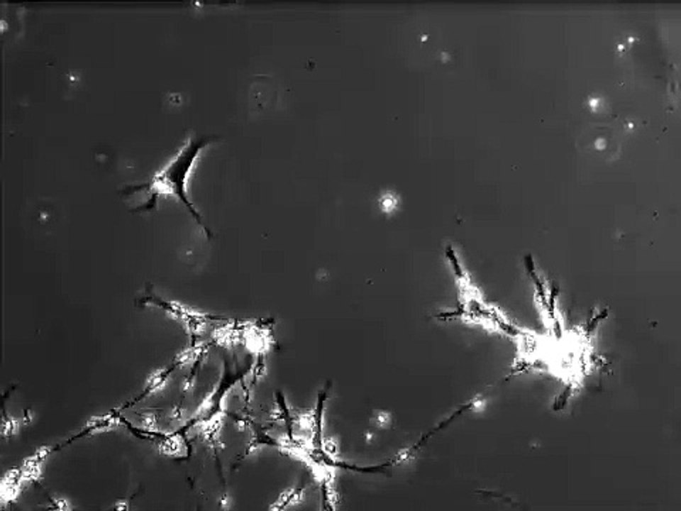 Neurons making new connection to other neurons