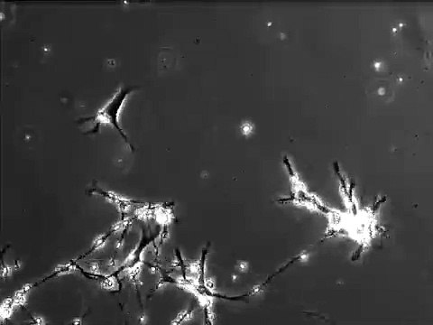 Neurons making new connection to other neurons