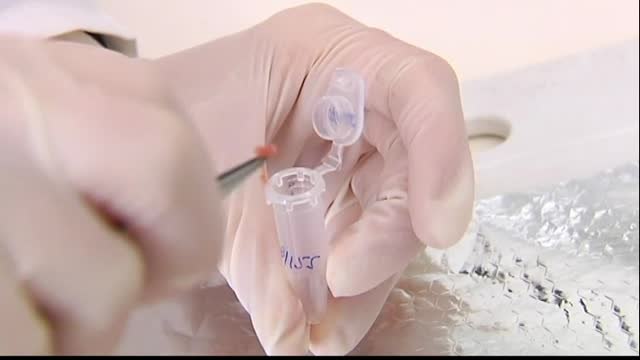 Aumenta los intoxicados por el brote de listeriosis registrado en España