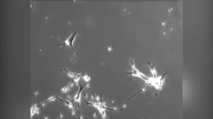 Des connections neuronales filmées au microscope électronique !