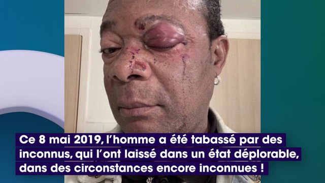 Maître Gims et Dadju : leur père tabassé à Paris, la photo CHOC de son visage !