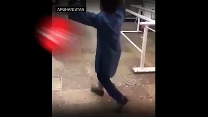 Yeni protez bacağıyla dans etti, mutluluğunu milyonlar izledi