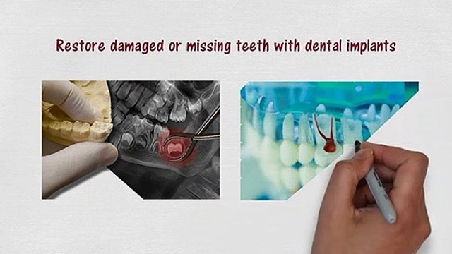 Restorative Dental Care in Stockton, CA