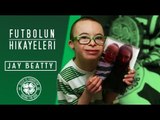 Down Sendromlu Celtic Taraftarı Jay Beatty'nin Hikayesi - Futbolun Hikayeleri
