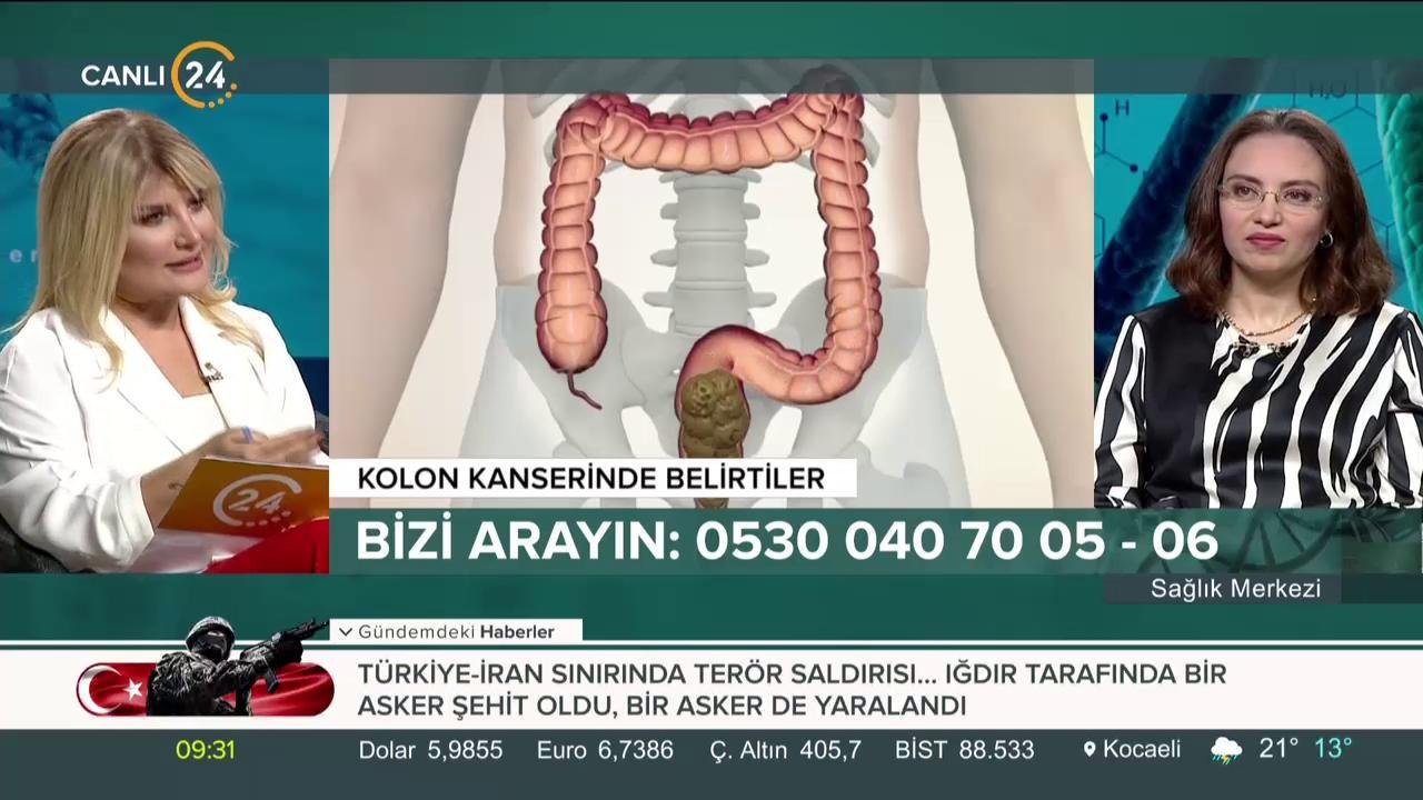 Kolon Kanseri