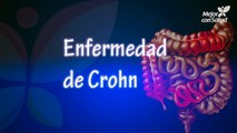 Enfermedad de Crohn: causas, síntomas y tratamiento