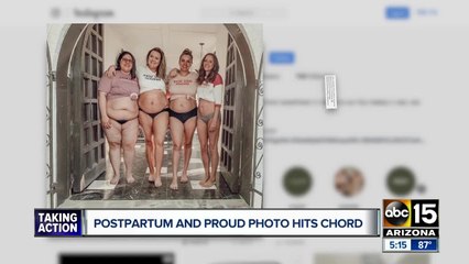 Gilbert moms go viral with postpartum picture
