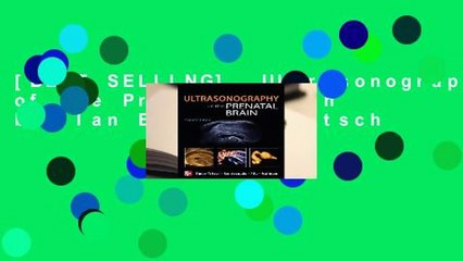 [BEST SELLING]  Ultrasonography of the Prenatal Brain by Ilan E. Timor-Tritsch