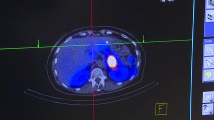 방사성 동위원소 자체 생산 가능...암 치료 '도약' / YTN