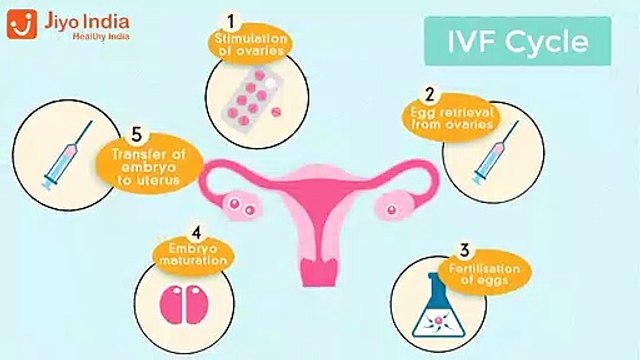 IVF(In Vitro Fertilization) | Procedure, Treatment & Success Rate | Jiyo India