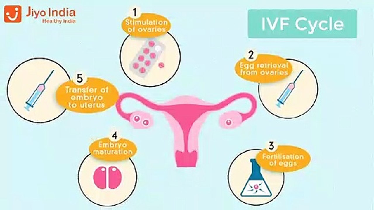 IVF(In Vitro Fertilization) | Procedure, Treatment & Success Rate | Jiyo India