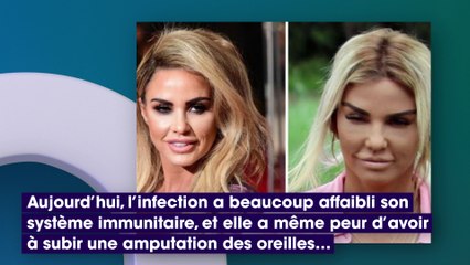 Après un lifting raté, cet ex-star de télé-réalité a peur de perdre ses oreilles !