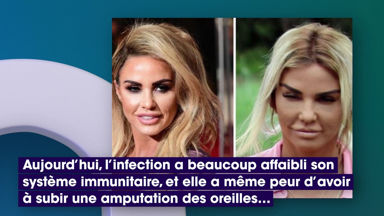 Après un lifting raté, cet ex-star de télé-réalité a peur de perdre ses oreilles !