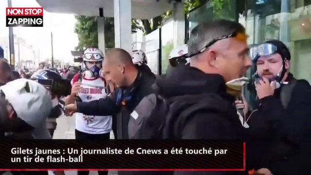 Gilets jaunes : Un journaliste de Cnews a été touché par un tir de flash-ball (vidéo)