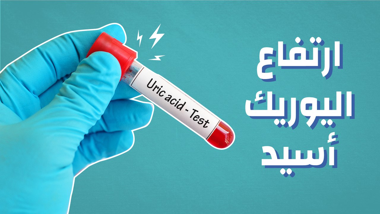 ارتفاع اليوريك أسيد