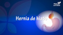 Hernia de hiato: tipos, síntomas y tratamientos