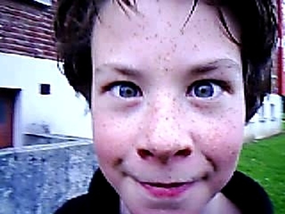 Alex casse guele
