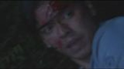 Samuel, aksidenteng nasaksak si Berto