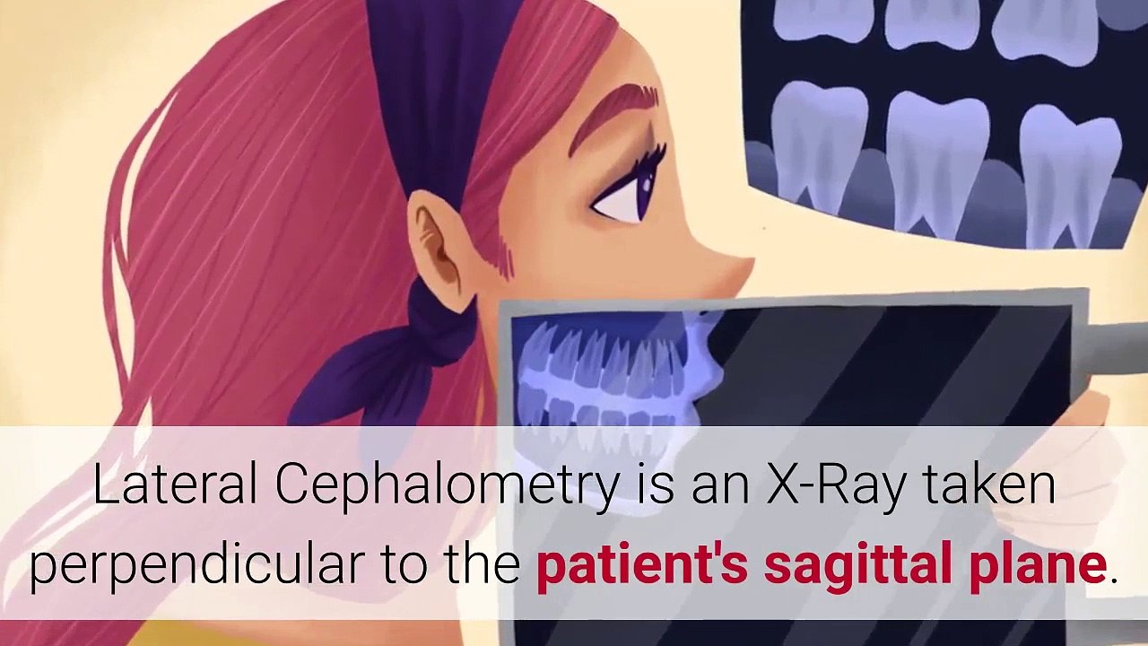 What Is Lateral Cephalometry? A Detail Explanation For You