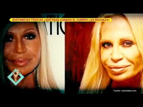 Famosas que sufrieron por las cirugías plásticas | De Primera Mano