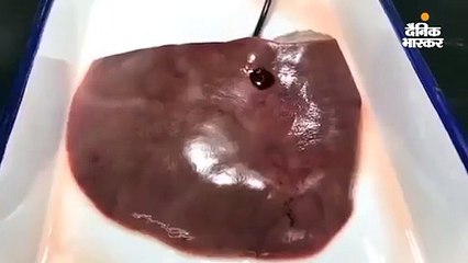 धड़कते दिल के घाव को 30 सेकंड में भरेगा 'बायो ग्लू', चीनी वैज्ञानिकों ने किया तैयार, दावा; यह विषैला नहीं