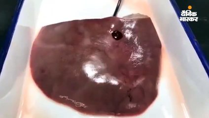 धड़कते दिल के घाव को 30 सेकंड में भरेगा 'बायो ग्लू', चीनी वैज्ञानिकों का दावा; यह विषैला नहीं