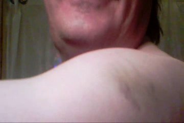 1550. MY FLUE SHOT ALMOST KILLED ME. OH AND THE BRUSE WAS JUST AS BAD.