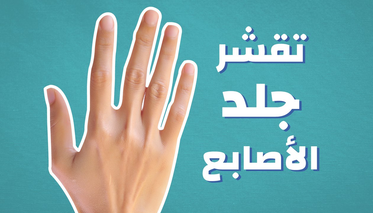 تقشر جلد الأصابع