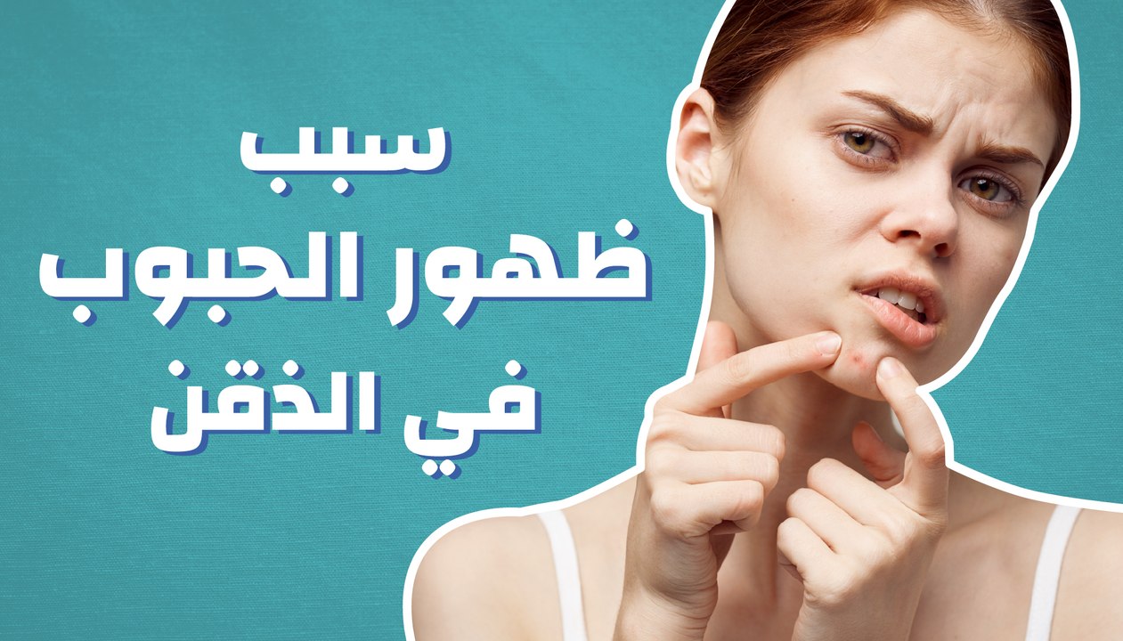 سبب ظهور الحبوب في الذقن