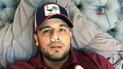 Alev makinası çalıştı, Meksikalı şarkıcının yüzüne denk geldi