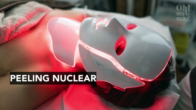 Estes novos peelings faciais prometem acabar com as manchas e rugas