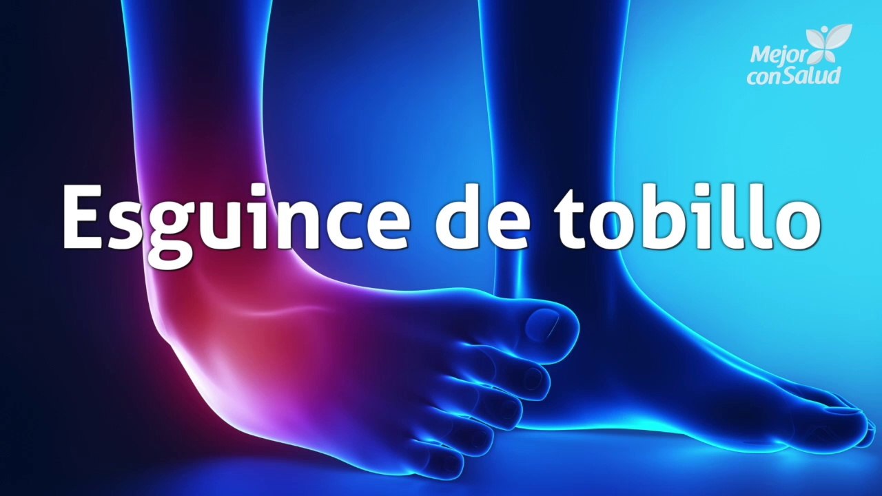 Esguince de tobillo: definición, síntomas y rehabilitación