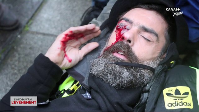 Violences policières : les gilets jaunes dénoncent - L'Info du Vrai du 22/05 - CANAL+