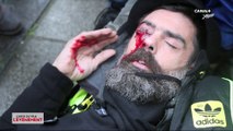 Violences policières : les gilets jaunes dénoncent - L'Info du Vrai du 22/05 - CANAL+