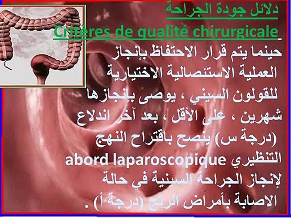 Diverticulose colique et diverticulite aiguë du sigmoïde Partie 2 داء الرتوج (الافتتاق) الجزء الثاني