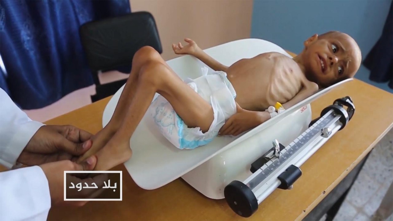 بلا حدود-هل الفاو قادرة على مجابهة انعدام الأمن الغذائي؟