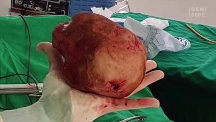 Forte bruciore e pesantezza alla pancia si rivelano sintomi di qualcosa di spaventoso