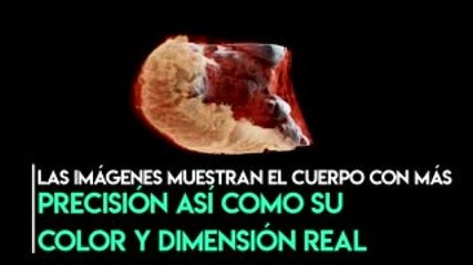 Download Video: Negocios | Este escáner muestra los órganos internos del cuerpo humano en 3D