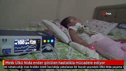 Video herunterladen: Minik Ülkü Nida ender görülen hastalıkla mücadele ediyor