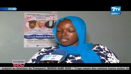 Témoignages poignants de personnes vivants avec le goître