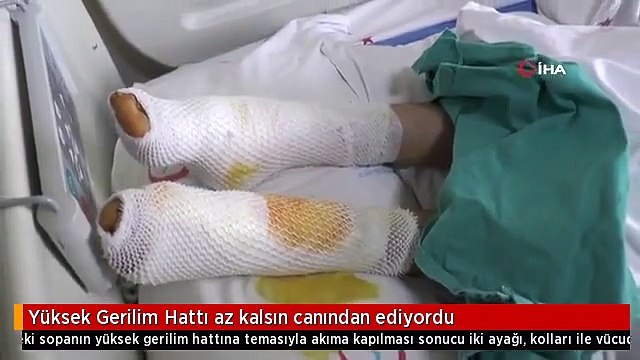 Yüksek Gerilim Hattı az kalsın canından ediyordu
