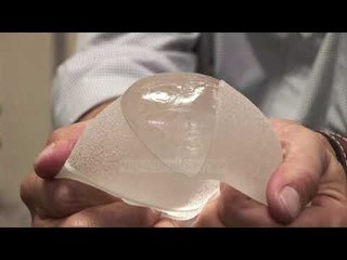 Proteza kancerogjene, Franca ndalon implantet e gjirit - Top Channel Albania - News - Lajme