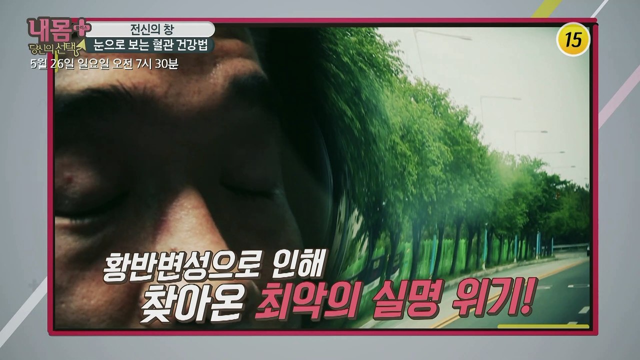 전신의 창, 눈으로 보는 혈관 건강법_내 몸 플러스 146회 예고