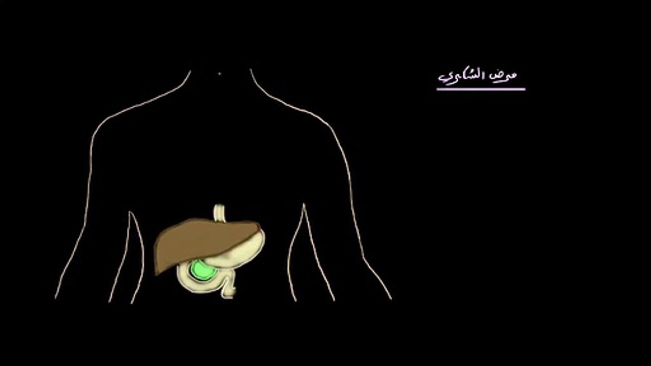 الفسيولوجيا المرضية للنوع الأول من مرض السكري