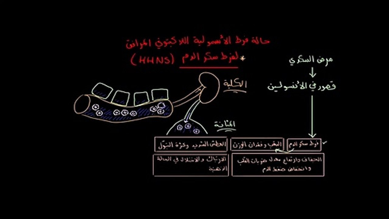 المضاعفات الحادة لمرض السكري   فرط الأسمولية اللاكيتوني المرافق لفرط سكر الدم