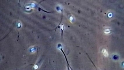 Santé - Don de gamètes