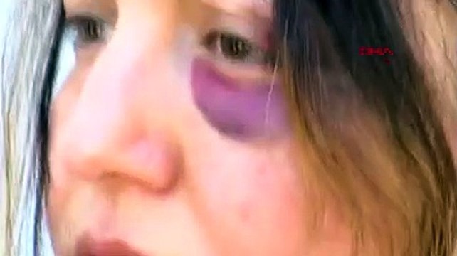 Çarptıkları yaralı kadına ilk müdahaleyi yapan hemşire, eşiyle birlikte darp edildi: Kaçmadık, ambulans çağırdık