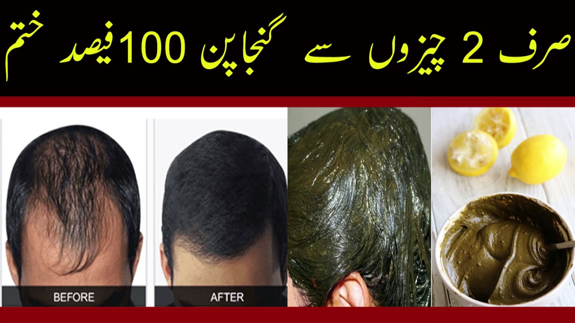 Hair Fall Treatment in Urdu || Ganjapan Ka Aasan Desi Ilaj || گنجا پن ہمیشہ  کیلیئے ختم - video Dailymotion