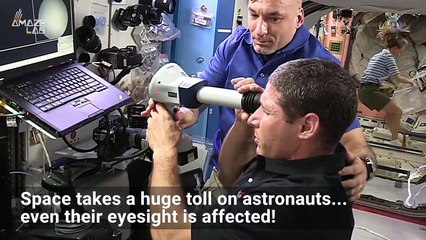 Why Astronauts Return from Space with Deformed Eyeballs